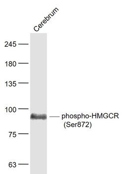 Phospho-HMGCR (Ser872) Rabbit anti-Human, Polyclonal, Bioss 100 &mu;L | Buy Online | Bioss | Fisher Scientific