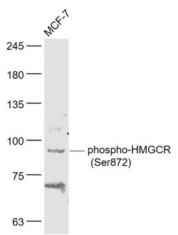Phospho-HMGCR (Ser872) Rabbit anti-Human, Polyclonal, Bioss 100 &mu;L | Buy Online | Bioss | Fisher Scientific