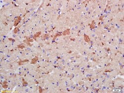 Phospho-LATS2 (Ser83) Rabbit anti-Human, Polyclonal, Bioss 100 &mu;L; Unconjugated:Antibodies,