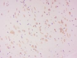 Phospho-LATS2 (Ser83) Rabbit anti-Human, Polyclonal, Bioss 100 &mu;L; Unconjugated:Antibodies,