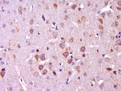 CTNNBIP1 Rabbit anti-Human, Polyclonal, Bioss 100 &mu;L; Unconjugated:Antibodies,