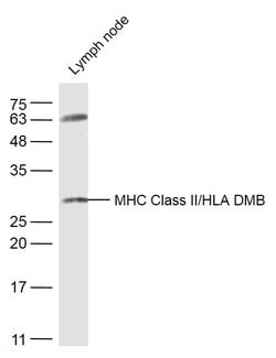 HLA-DPB1 Rabbit anti-Human, Polyclonal, Bioss 100 &mu;L; Unconjugated:Antibodies,