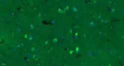 GABA A Receptor gamma 2 Rabbit anti-Human, Polyclonal, Bioss 100 &mu;L;