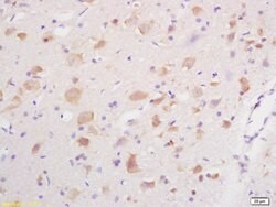 GABA A Receptor gamma 2 Rabbit anti-Human, Polyclonal, Bioss 100 &mu;L;