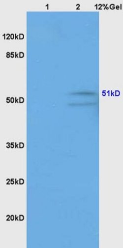 GABA A Receptor gamma 2 Rabbit anti-Human, Polyclonal, Bioss 100 &mu;L;