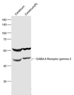 GABA A Receptor gamma 2 Rabbit anti-Human, Polyclonal, Bioss 100 &mu;L;