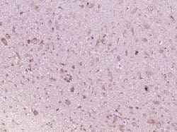 IFNAR1 Rabbit anti-Human, Polyclonal, Bioss 100 &mu;L; Unconjugated:Antibodies,