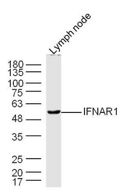 IFNAR1 Rabbit anti-Human, Polyclonal, Bioss 100 &mu;L; Unconjugated:Antibodies,
