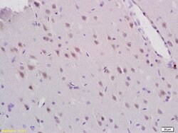 MEK5 Rabbit anti-Human, Polyclonal, Bioss 100 &mu;L; Unconjugated:Antibodies,
