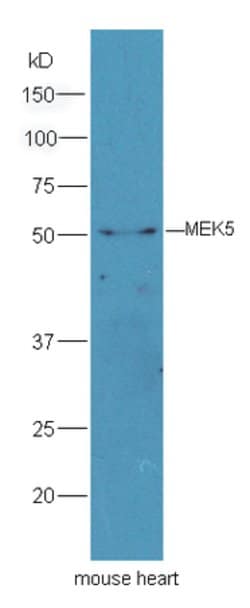 MEK5 Rabbit anti-Human, Polyclonal, Bioss 100 &mu;L; Unconjugated:Antibodies,
