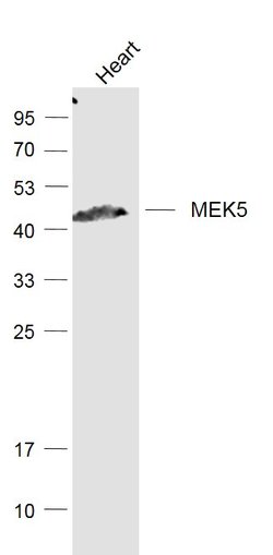 MEK5 Rabbit anti-Human, Polyclonal, Bioss 100 &mu;L; Unconjugated:Antibodies,