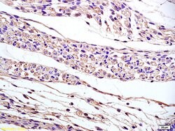 PAP2B Rabbit anti-Human, Polyclonal, Bioss 100 &mu;L; Unconjugated:Antibodies,