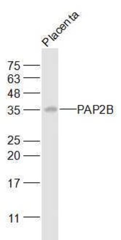 PAP2B Rabbit anti-Human, Polyclonal, Bioss 100 &mu;L; Unconjugated:Antibodies,