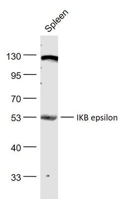 IKB epsilon Rabbit anti-Human, Polyclonal, Bioss 100 &mu;L | Buy Online | Bioss | Fisher Scientific