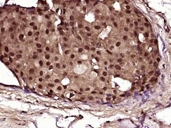 NF1 Rabbit anti-Human, Polyclonal, Bioss 100 &mu;L; Unconjugated:Antibodies,