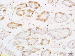 PRKD3 Rabbit anti-Human, Polyclonal, Bioss 100 &mu;L; Unconjugated:Antibodies,