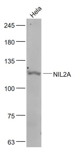 ZEB1/2 Rabbit anti-Human, Polyclonal, Bioss 100 &mu;L; Unconjugated:Antibodies,