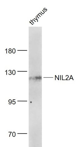 ZEB1/2 Rabbit anti-Human, Polyclonal, Bioss 100 &mu;L; Unconjugated:Antibodies,
