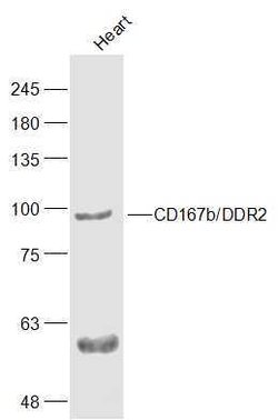 CD167b Rabbit anti-Human, Polyclonal, Bioss 100 &mu;L; Unconjugated:Antibodies,