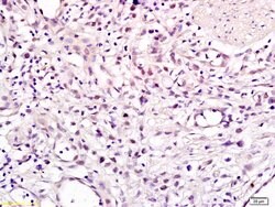 CHMP1A Rabbit anti-Human, Polyclonal, Bioss 100 &mu;L; Unconjugated:Antibodies,
