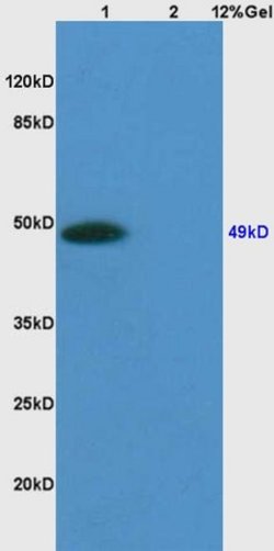 Sphingomyelin Synthase 1 Rabbit anti-Human, Polyclonal, Bioss 100 &mu;L;