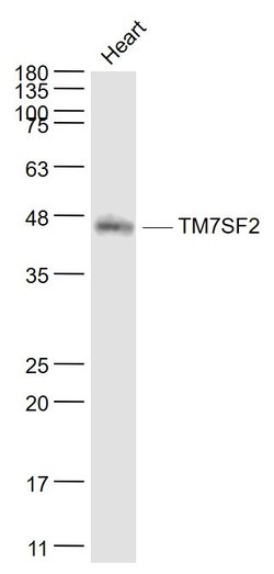 TM7SF2 Rabbit anti-Human, Polyclonal, Bioss 100 &mu;L | Buy Online | Bioss | Fisher Scientific