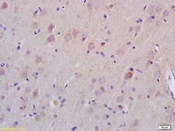 ZDHHC21 Rabbit anti-Human, Polyclonal, Bioss 100 &mu;L; Unconjugated:Antibodies,