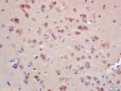 CHRNB Rabbit anti-Human, Polyclonal, Bioss 100 &mu;L; Unconjugated:Antibodies,