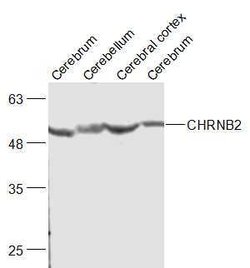 CHRNB Rabbit anti-Human, Polyclonal, Bioss 100 &mu;L; Unconjugated:Antibodies,