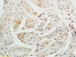 P2X3 Rabbit anti-Human, Polyclonal, Bioss 100 &mu;L; Unconjugated:Antibodies,