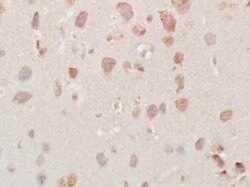 Vesicle docking protein p115 Rabbit anti-Human, Polyclonal, Bioss 100 &mu;L;