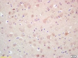 MAP 1A/1B LC3 Alpha/Beta Rabbit anti-Human, Polyclonal, Bioss 100 &mu;L;