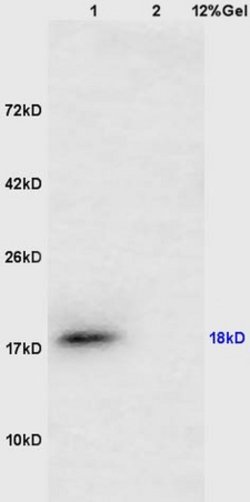 CTAG1 Rabbit anti-Human, Polyclonal, Bioss 100 &mu;L; Unconjugated:Antibodies,