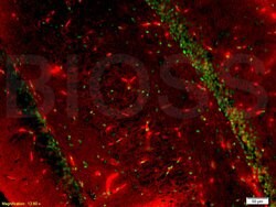 tubulin Beta Rabbit anti-Human, Polyclonal, Bioss 100 &mu;L; Unconjugated:Antibodies,