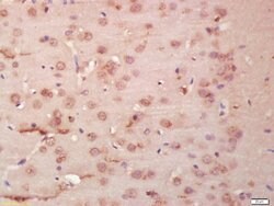 tubulin Beta Rabbit anti-Human, Polyclonal, Bioss 100 &mu;L; Unconjugated:Antibodies,