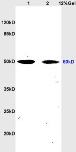 tubulin Beta Rabbit anti-Human, Polyclonal, Bioss 100 &mu;L; Unconjugated:Antibodies,