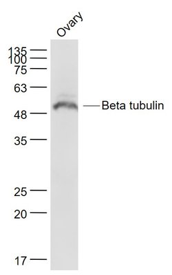 tubulin Beta Rabbit anti-Human, Polyclonal, Bioss 100 &mu;L; Unconjugated:Antibodies,