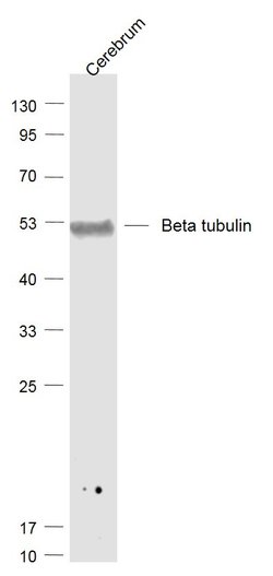 tubulin Beta Rabbit anti-Human, Polyclonal, Bioss 100 &mu;L; Unconjugated:Antibodies,