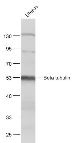 tubulin Beta Rabbit anti-Human, Polyclonal, Bioss 100 &mu;L; Unconjugated:Antibodies,