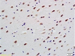 beta 3 Tubulin Rabbit anti-Human, Polyclonal, Bioss 100 &mu;L; Unconjugated:Antibodies,