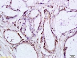 BRLF1 Rabbit anti-Human, Polyclonal, Bioss 100 &mu;L; Unconjugated:Antibodies,