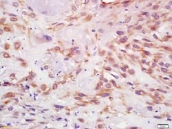 IGF 1 Rabbit anti-Human, Polyclonal, Bioss 100 &mu;L; Unconjugated:Antibodies,
