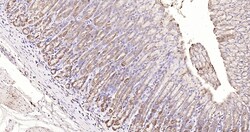 MMP-1 Polyclonal Antibody, Bioss 100 &mu;L | Buy Online | Bioss | Fisher Scientific