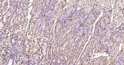 MMP-1 Polyclonal Antibody, Bioss 100 &mu;L | Buy Online | Bioss | Fisher Scientific