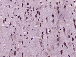 MMP-1 Polyclonal Antibody, Bioss 100 &mu;L | Buy Online | Bioss | Fisher Scientific