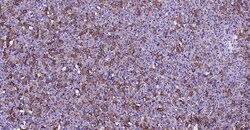 MMP-1 Polyclonal Antibody, Bioss 100 &mu;L | Buy Online | Bioss | Fisher Scientific
