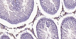 MMP-1 Polyclonal Antibody, Bioss 100 &mu;L | Buy Online | Bioss | Fisher Scientific