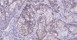 MMP-1 Polyclonal Antibody, Bioss 100 &mu;L | Buy Online | Bioss | Fisher Scientific