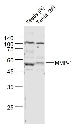MMP-1 Polyclonal Antibody, Bioss 100 &mu;L | Buy Online | Bioss | Fisher Scientific