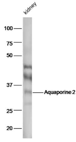 AQP2 Rabbit anti-Human, Polyclonal, Bioss 100 &mu;L; Unconjugated:Antibodies,